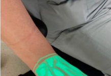 New equipment to help babies, paediatric patients with hard-to-find veins at Abbotsford hospital