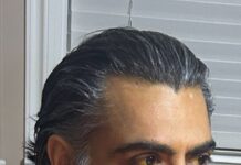 Vancouver Police searching for missing man with liver disease