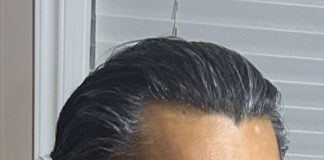 Vancouver Police continue searching for missing man with liver disease